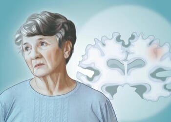 Alzheimer's Disease: The Most Common Neurodegenerative Disease - Here Are The Causes
