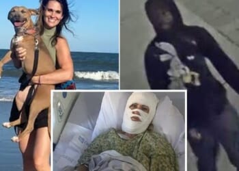 Georgia Woman Attacked With 'Corrosive' Chemical After Christmas Event, Suffers Third-Degree Burns