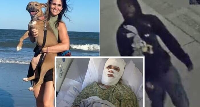 Georgia Woman Attacked With 'Corrosive' Chemical After Christmas Event, Suffers Third-Degree Burns