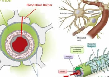 Reversing Alzheimer's: The Forgotten Causes And Cures Big Pharma Buried