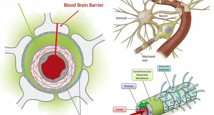 Reversing Alzheimer's: The Forgotten Causes And Cures Big Pharma Buried