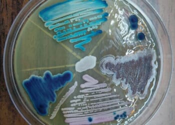 The Trump Administration's Fight To Fund Scientists